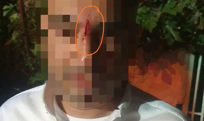 תקיפת יהודי בשמעון הצדיק: המשטרה תאסוף תיעוד ממצלמות האבטחה