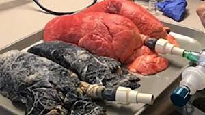 ×ª××¦××ª ×ª××× × ×¢×××¨ ×¨××××ª ×©× ××¢×©×