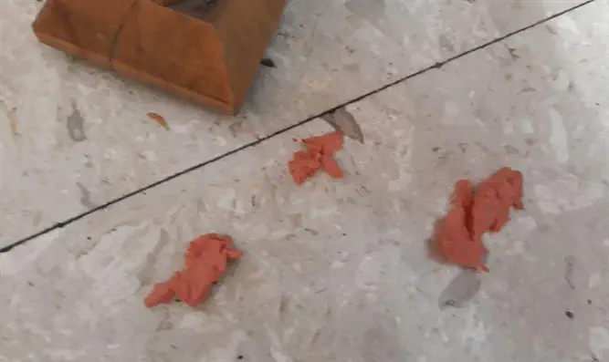 חלקי הנקניק שהוציאו מקנה הנשימה של הפעוטה