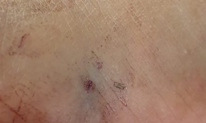 אזור ההכשה בכף רגלה של הפעוטה