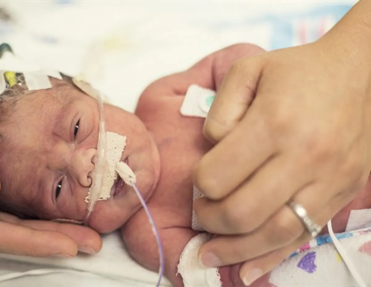 First time in Israel Cardiac catheterization on tiny baby Israel