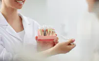 כיצד לבצע השתלות שיניים?