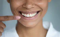 How good, healthy teeth help your confidence