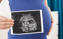 זיהוי סימנים מוקדמים לאוטיזם - לפני לידה