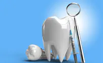 השתלות שיניים מתקדמות: נקודות שחשוב להכיר