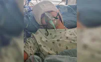 Jewish teen unconscious after Arab hurls rock at his head