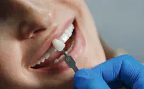 השתלות שיניים                  
