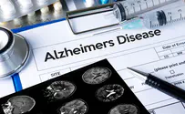 Israeli researchers make breakthrough in Alzheimer's research