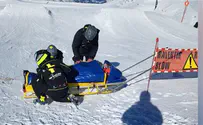 Robotic surgery saves Jerusalem doctor injured in ski accident