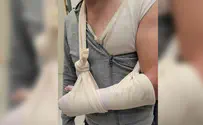 Officers beat journalist, break his arm