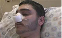 Yeshiva Student Brutally Beaten on Mount Hermon