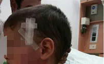 Мать малыша: брошенный арабами камень задел его голову