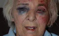 82-year old woman assaulted in UK violent home invasion