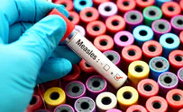 Measles epidemic kills over 1,200 in Madagascar