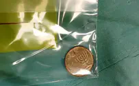 ניתוחים מוצלחים לילדים שבלעו מטבעות