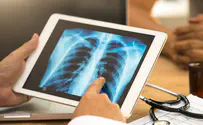מכבי בחיפוש אחר חולי ה-COPD