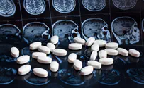 FDA approves drug to treat Alzheimer's
