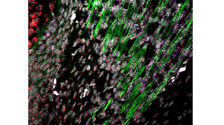 צפיפות הצבעים ירוק-אדום-סגול מעידה על קיומם של תאים היברידיים