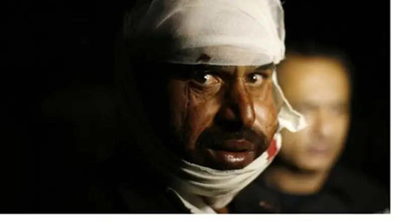 Injured Pakistani man