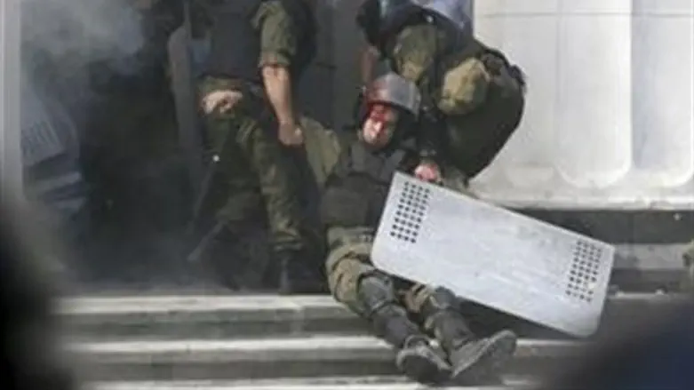 Раненый нацгвардеец у Верховной Рады в Киеве