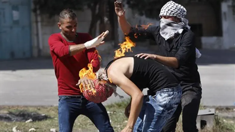 Arab terrorist sets himself on fire with firebomb