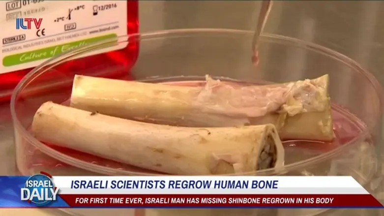 Israeli scientists regrow human bone