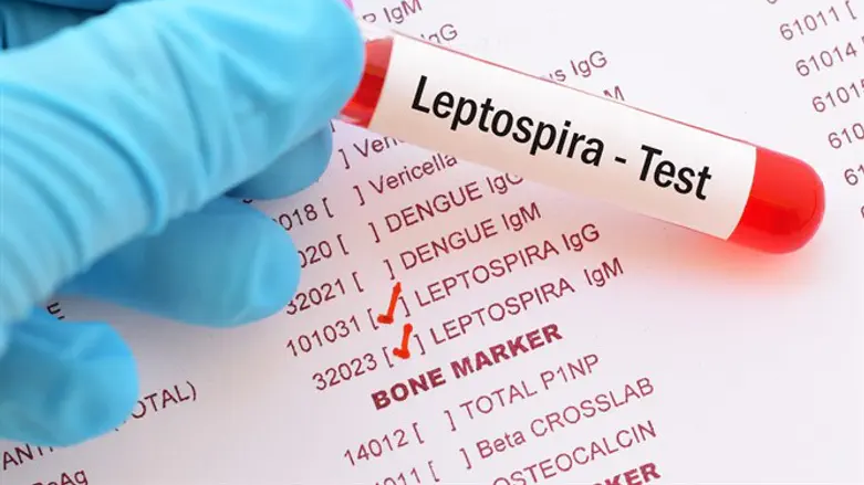 Leptospira test