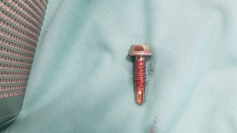 Screw removed from baby's throat