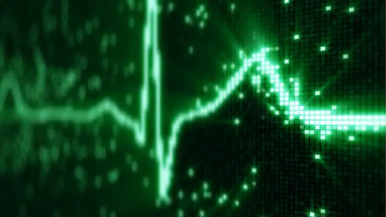 EKG electrocardiogram pulse waveform