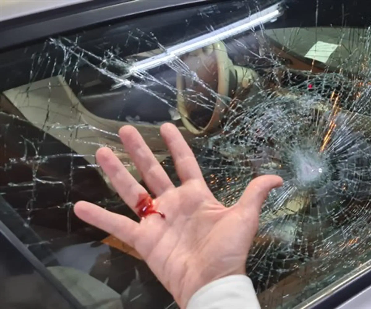 Rabbi Eliyahu's driver suffered injuries to his hand