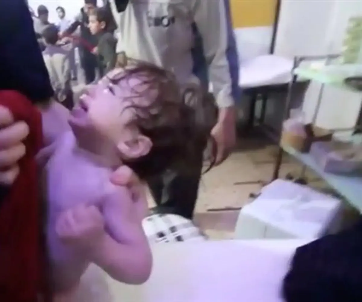 Douma baby receives treatment after chemical attack