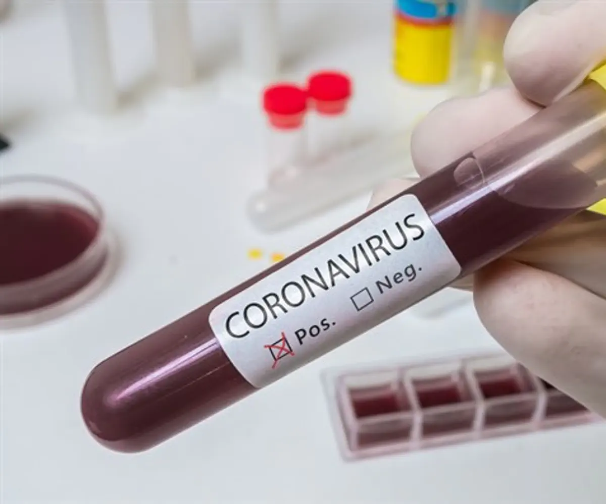 Coronavirus test 