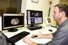 מחקר חדש יטמיע בינה מלאכותית ב-MRI