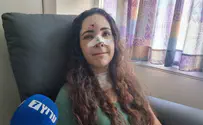 Woman recovers from stone attack: "One millimeter and I might not be here"