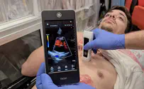 Magen David Adom to unveil ultrasound technology on ambulances