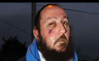 Victim of Arab Mob: Police Refused to Believe I Was Hurt
