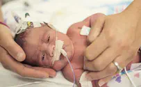 World's smallest surviving baby released from hospital