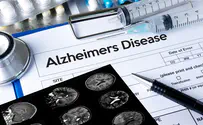 Can new Alzheimer's treatment solve the disease? 