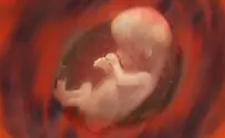 US abortion debate - are Dems into child sacrifice?
