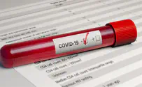 US tops 26 million cases of COVID-19