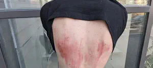 ארגון חוננו: שוטרים היכו נערים