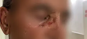 אב ובנו הותקפו ביפו, "הם השתוללו והיכו בטירוף"