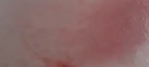 בעיטות, אגרופים, אבנים ותרסיס גז 