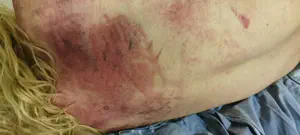 תיעוד: צעיר יהודי הותקף בשכונת שמעון הצדיק, "מכות רצח של ממש"