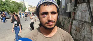 "בקבוק זכוכית שבור לתוך הפנים"