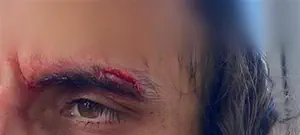 תיעוד: ערבים תקפו חרדי בדרך שכם בירושלים ונמלטו