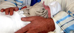 הנחיה בצרפת: לדחות ברית מילה