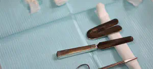 ברית מילה בגיל 80