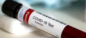 משרד הבריאות: 229 בני אדם אובחנו אתמול עם קורונה