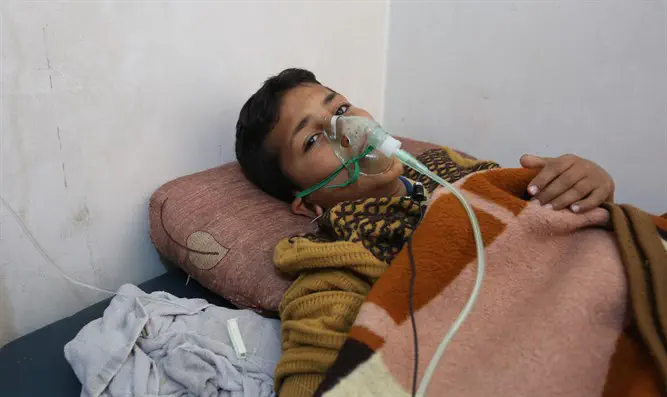  Hassan Dallal, a survivor of the chemical attack in Syria, receiving medical treatment at
